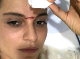 OMG! Kangna Ranaut gets SEVERELY INJURED while shooting for Manikarnika- The Queen Of Jhansi
