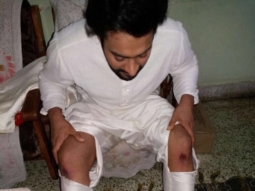 Jackky Bhagnani injures himself on the sets of his film in Ahmedabad