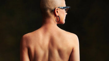 Tahira Kashyap Khurrana goes backless, proudly bears her scars in a powerful message on World Cancer Day