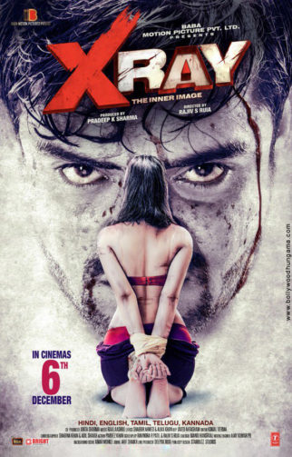 First Look Of X Ray - The Inner Image