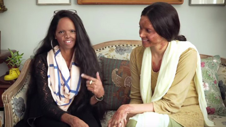 Chhapaak | Face Of Chhapaak | Deepika Padukone | Vikrant Massey | Meghna Gulzar Chhapaak | Face Of Chhapaak | Deepika Padukone | Vikrant Massey | Meghna Gulzar