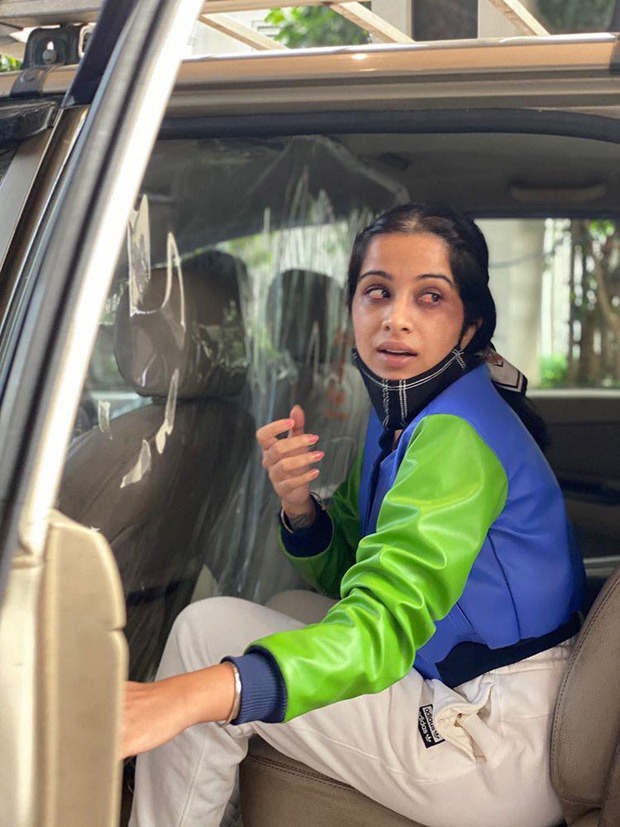 Bigg Boss 14 This picture of Sara Gurpal's eyes' injury by Nikki Tamboli's acrylic nails is shocking!