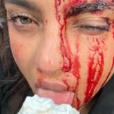 Priyanka Chopra is bloodied and bruised as she enjoys ice-cream on the sets of Citadel