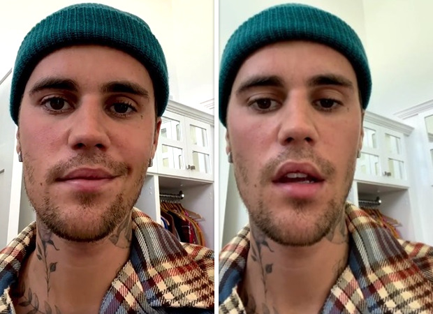 Justin Bieber suffering from partial face paralysis caused by Ramsay Hunt Syndrome - "Extremely frustrating, please pray for me"