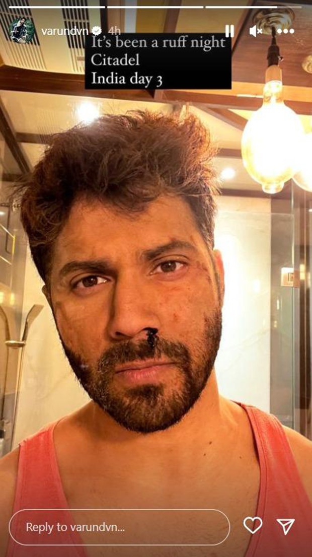 Varun Dhawan poses with a bleeding nose on sets of Citadel India; says, “It’s been a ruff night”