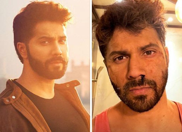 Varun Dhawan poses with a bleeding nose on sets of Citadel India; says, “It’s been a ruff night”