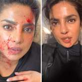 Priyanka Chopra says her 'glamorous' job involves blood, sweat and tears, shares a bloody and bruised video from Citadel set ahead of finale