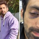 Khatron Ke Khiladi 13: Arjit Taneja gets injured while performing a stunt