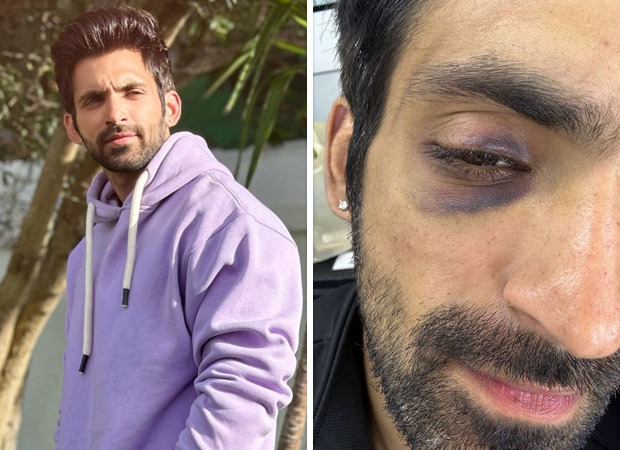 Khatron Ke Khiladi 13: Arjit Taneja gets injured while performing a stunt