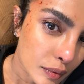 Priyanka Chopra sustains minor injury on the sets of Heads of State; shares bloodied up picture