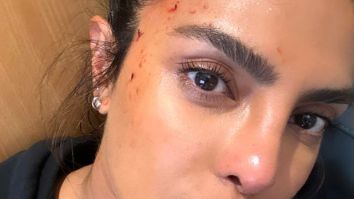 Priyanka Chopra sustains minor injury on the sets of Heads of State; shares bloodied up picture