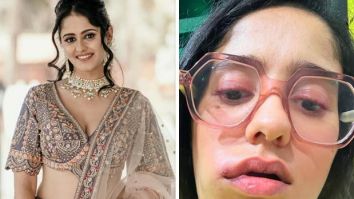 GHKKPM actress Ayesha Singh reveals ‘no accurate diagnosis’ for her face swelling; says, “I have connected with a third doctor, and yet we can’t pinpoint the root cause”