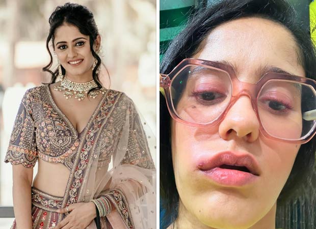 GHKPM actress Ayesha Singh reveals ‘no accurate diagnosis’ for her face swelling; says, “I have connected with a third doctor, and yet we can’t pinpoint the root cause” 