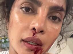 Action movies require blood & sweat, quiet literally & Priyanka Chopra proves it!