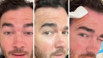 Kevin Jonas undergoes surgery for skin cancer, shares health update on Instagram