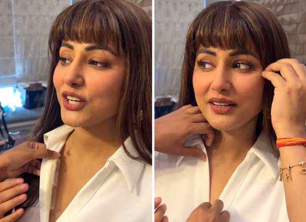 Hina Khan prepares for first shoot after first chemo session; hides stitches, puts wig with fringes: “I am undergoing treatment but I am not always in the hospital”