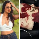 Kashmera Shah narrowly escapes “freak” accident in the USA, shares photo of blood-soaked tissue: “Kuch bada hone wala tha…”