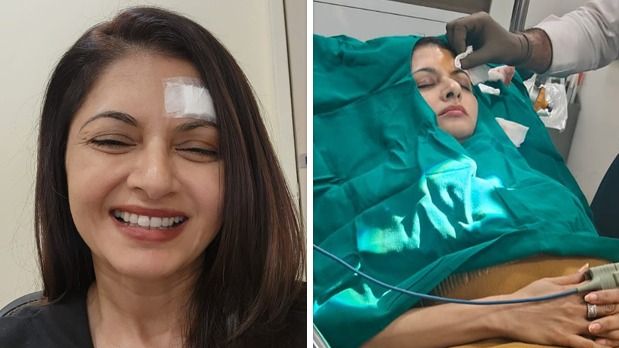 Bhagyashree gets 13 stitches on forehead after getting injured while playing pickleball