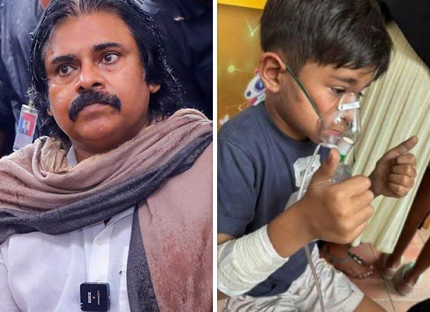 Photo of Pawan Kalyan’s son Mark Shankar after he gets injured in school fire in Singapore goes viral