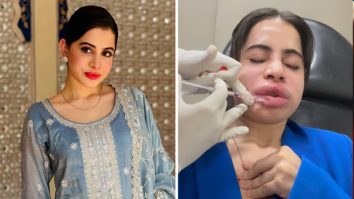 Uorfi Javed gets lip fillers dissolved on camera; reveals painful experience and future plans