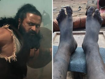 Rishab Shetty shares ‘swollen leg’ BTS photos from Kantara: The Legend Chapter 1; makes shocking revelation about painful climax Rishab Shetty shares ‘swollen leg’ BTS photos from Kantara: The Legend Chapter 1; makes shocking revelation about painful climax