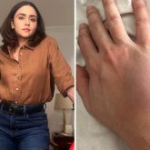 Amruta Khanvilkar recalls injury during intense Taskaree action shoot: “My wrist remained swollen for over a month”