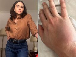 Amruta Khanvilkar recalls injury during intense Taskaree action shoot: “My wrist remained swollen for over a month”