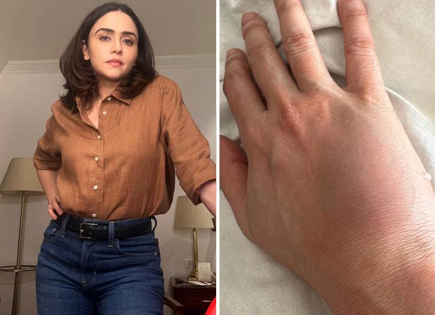 Amruta Khanvilkar recalls injury during intense Taskaree action shoot: "My wrist remained swollen for over a month"