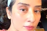 Skin care is the priority! Manisha Koirala