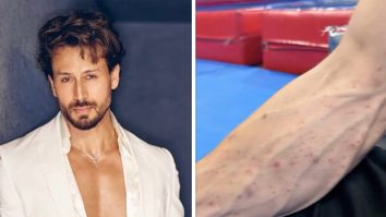 Tiger Shroff team shares video of his injuries after Juhu firing incident; actor reportedly sustained cuts and bruises