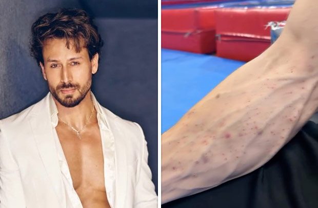 Tiger Shroff team shares video of his injuries after Juhu firing incident; actor reportedly sustained cuts and bruises